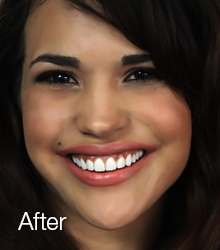 bri after