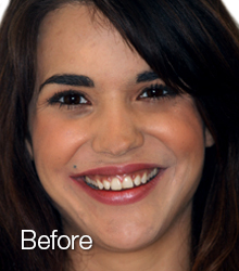 bri before